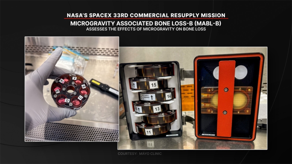 NASA bone loss in space